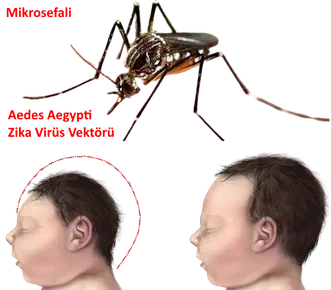 Zika Virüsü & Hamilelik
