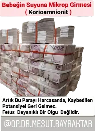 Kimler Mikroba Dayanıklı ! Fetus Mu?