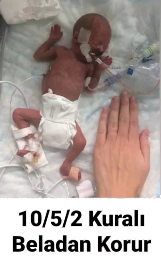 Erken Doğumu; (Önlet)mek