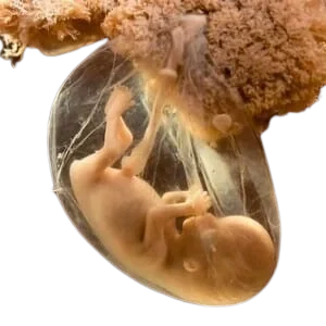 Kori̇oamni̇oni̇t: Bebeğe Mikrop Bulaşması Tehlikeli mi?