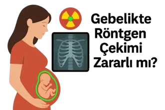 Gebelikte Röntgen Çekimi Zararlı mı?