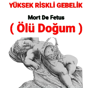 Ölü Doğum – Mort De Fetus