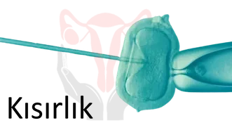 Kısırlık – İnfertilite