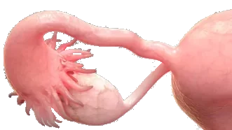 Tuba Uterina Tıkanıklığı – Tüplerin Kapalı Olması