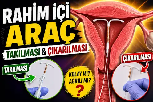 Muğla Spiral Takılması & Çıkarılması