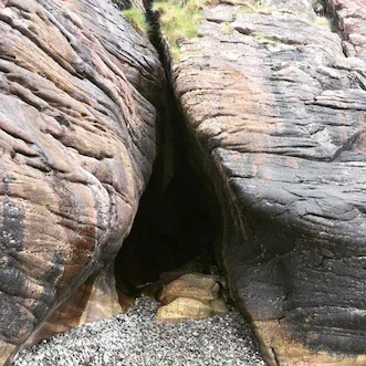 Genital Beyazlatma – Lazerle Vajina Beyazlatma