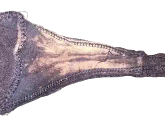 Vajinal Akıntı İç Çamaşırını Beyazlatır mı? Risk mi?