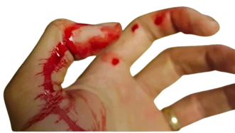 Hamilelikte Kanama | Gebelikte Kanama