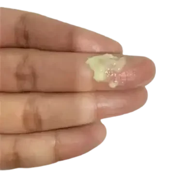 Vajinal Akıntı – Vajinal Balgam