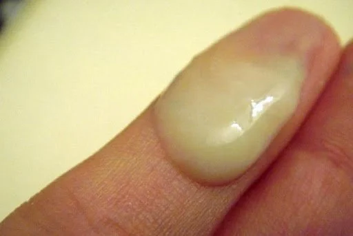 Vajinada Yeşil Akıntı İçin Bitkisel Çözüm