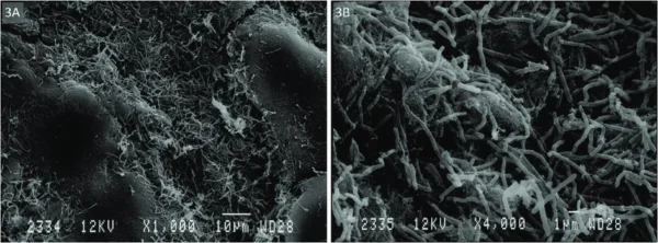 Vajinal Mi̇krobi̇yom Vajinal Mikrobiyota