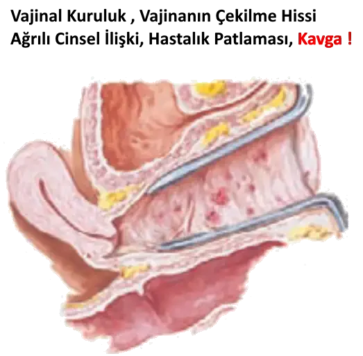 Vajinal Kuruluk: Kurumuş Vaji̇na & Kurutulmuş Vajina