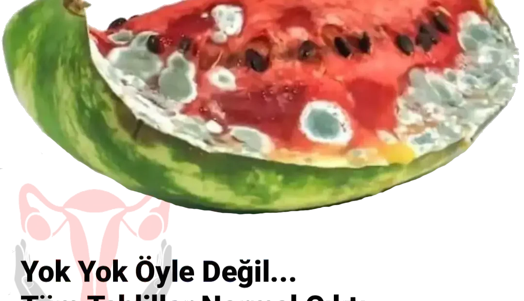 Ölüm Garanti Olunca İnsanlar Neden Doktora Koşar ?