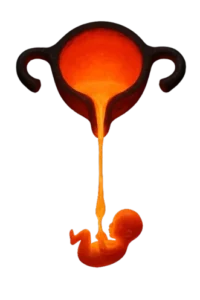 rahim pota ocağı - rahim anomalisi uterin malformasyon fetus - Muğla kadın doğum