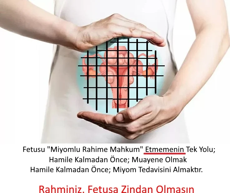 Muğla Gebelikte Miyom