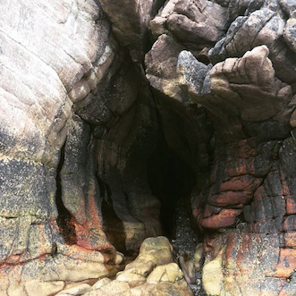 Kadın Genital Bölge Kararması – Vulvar Acanthosi̇s Ni̇gri̇cans