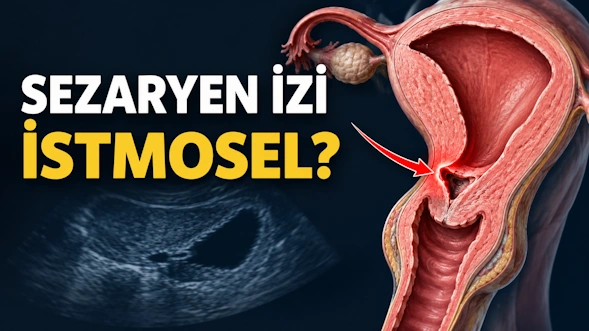 İstmosel Kendiliğinden Geçer Mi?