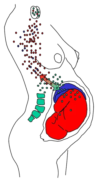 Hashimato , Graves Hastalığı Gibi Durumlarda Mikrokimerizm : Gebelik, doğal mikrokimerizmin önemli kaynağıdır. Gebelikle ilişkili mikrokimerizm, maternal dolaşımı fetal dolaşımdan ayıran doğal plasental fiziksel engel dokusunda meydana gelen eksikliklerden kaynaklanır. 