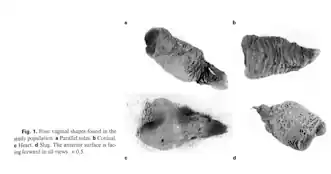 vajina şekilleri ve yüzey alanı - fakat bu doldurulduğu için bu şekildedir, normalde kapalıdır.