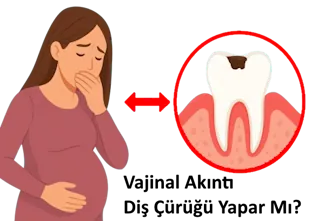 Gebelikte Diş Çürüğü
Vajinal akıntı diş çürüğü gebelik - Muğla kadın doğum