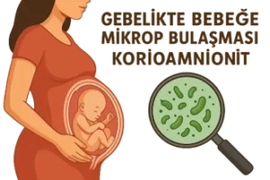 Gebelikte Bebeğe Mikrop Bulaşması - Korioamnionit