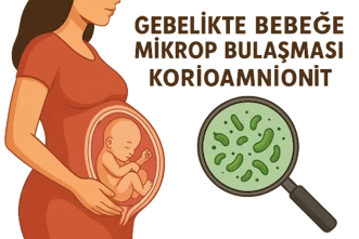 Bebeğe Mikrop Bulaşması – Korioamnionit