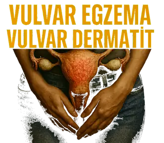 Vulvar Egzema | Vulvar Dermatit