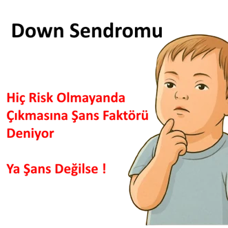 Down Sendromu Trizomi 21