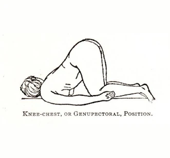 retrovert uterus gögüs diz pozisyonu