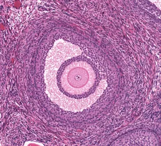 sekonder antral folikül