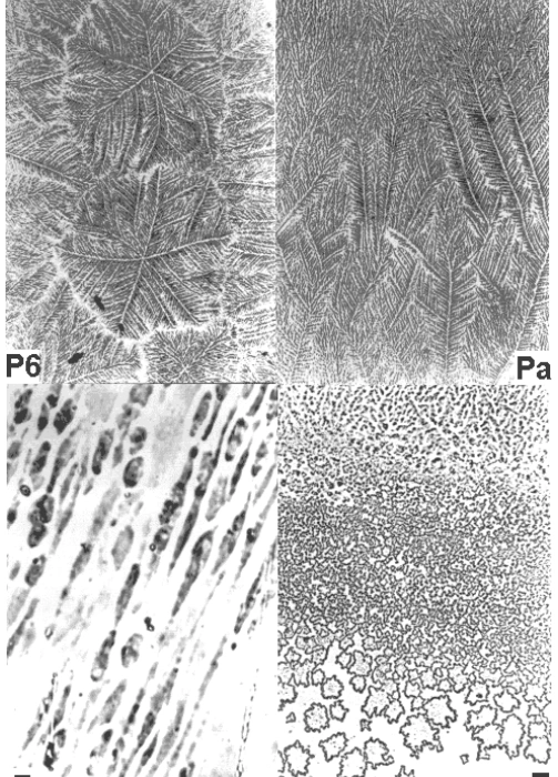 servikal mukus mikroskopi